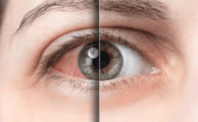 retina2