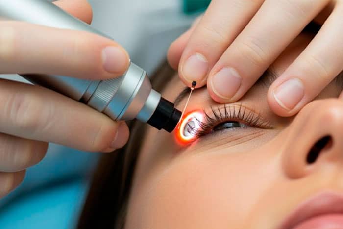 tratamiento-avanzado-para-glaucoma-en-ojos