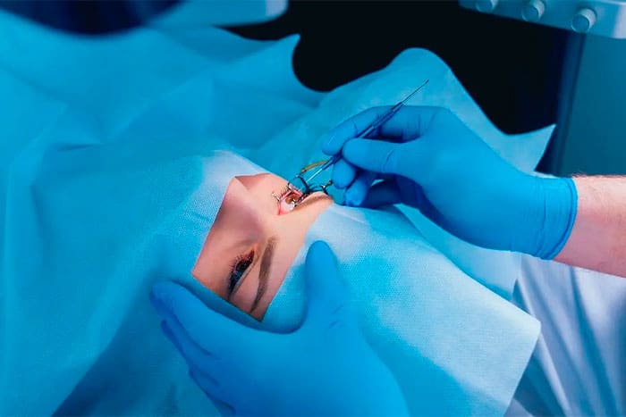 cirugía-LASIK-en-Lima
