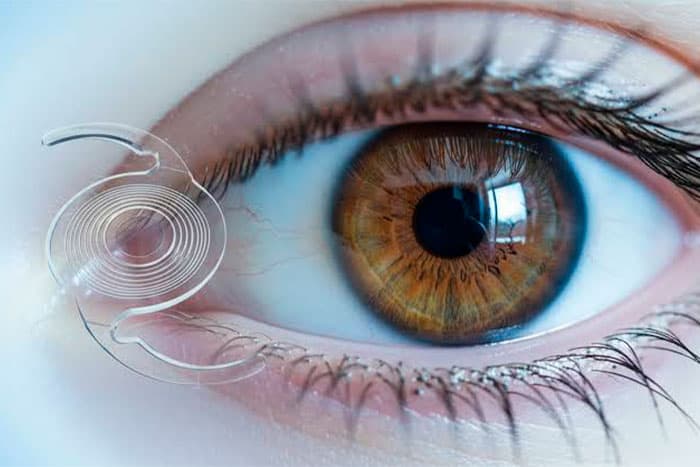 lente-intraocular-multifocal-precio