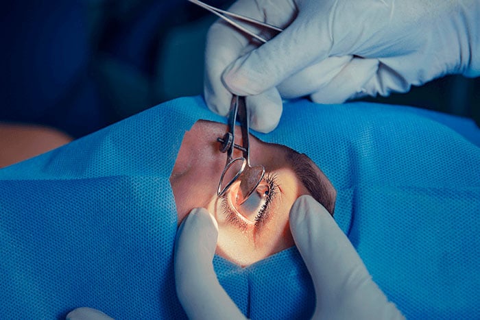 Desprendimiento-de-retina