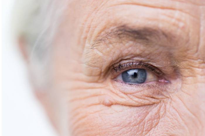 degeneración macular síntomas
